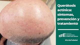 Queratosis actínica qué es prevención diagnóstico y tratamiento  CuidaTuSalud [upl. by Guthrey]