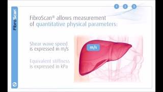 3 Stages of the FibroScan examination [upl. by Akinor]