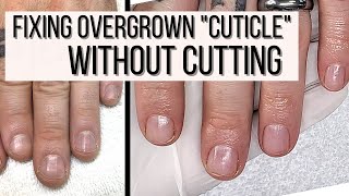 How to FIX Overgrown Cuticles WITHOUT CUTTING [upl. by Eugaet]