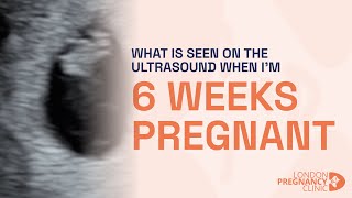 6 Weeks Pregnant Witnessing the First Heartbeat on ultrasound scan [upl. by Aniz]