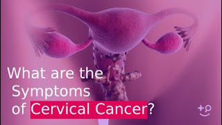 What are the Symptoms of Cervical Cancer [upl. by Ardek]