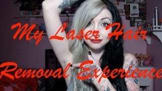 My bad Laser Hair Removal Experience [upl. by Pollock]