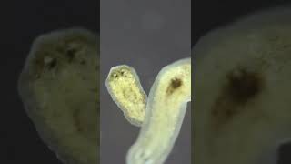 Planarian parasite flatworms under microscope [upl. by Akinajnat]