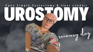 Urostomy  Ileal Conduit amp Open Cystectomy Surgery Recovery Vlog [upl. by Evol115]