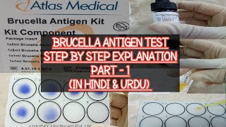 Brucella Antigen test Procedure amp Practical explained step by stepBrucellosisBrucella A amp M Specie [upl. by Ahsinauq]