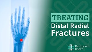 Treating Distal Radius Fractures at Dartmouth Health [upl. by Norean]