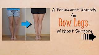 Braces for Bow Legs  Can Braces Correct Bow Legs Here is the Truth [upl. by Schuman272]