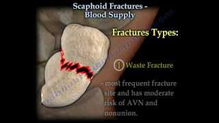 Scaphoid Fractures Blood Supply  Everything You Need To Know  Dr Nabil Ebraheim [upl. by Emmeram953]