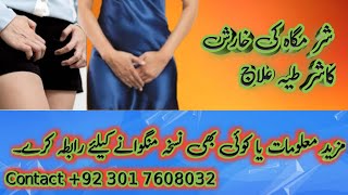 Get Rid Of Itching In Private Parts Aurat Ki Sharamgah Ki Kharish Ka ilaj [upl. by Yreneh]