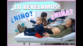 REVELAMOS si es NIÑO O NIÑA  LA REACCIÓN de HERMANA MAYOR al ver al BEBÉ  12 SEMANAS de EMBARAZO [upl. by Earissed]