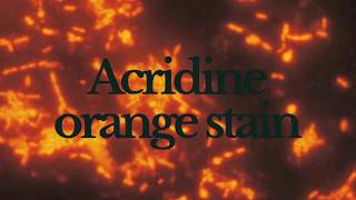 Acridine Orange Staining  Principle Method and Result [upl. by Ymor13]