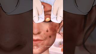 asmr face treatment shorts asmr skincare animation makeover asmrsounds AllASMRFactz [upl. by Rosenfeld]