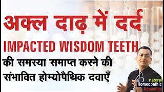 अक्ल दाढ़ में दर्द  Impacted Wisdom Teeth  Natural homeopathic remedies with symptoms [upl. by Anelat]