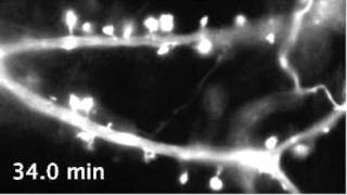 Dynamic actin filaments in dendritic spines [upl. by Elleivad892]