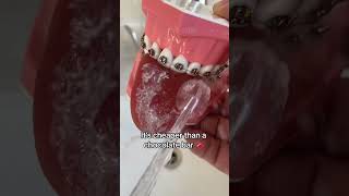 🦷 Water Flosser for Teeth 💧 4 Jet Tips for Home amp Travel 🛫 [upl. by Neemsay]