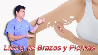 ¿Qué es el Lifting de Brazos y el Lifting de Piernas [upl. by Gazzo]