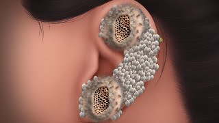 ASMR Ear piercing treatment removes animation re  asmr treatments 2d [upl. by Edalb]