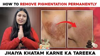 How to remove Pigmentation Permanently  Best Home Remedies  Skin Care Tips  Upasana Ki Duniya [upl. by Varian]