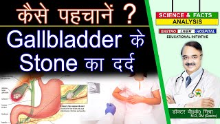 कैसे पहचानें  गॉलब्लडैर के Stone का दर्द  GALL BLADDER STONE PAIN ATTACK [upl. by Airdnala440]