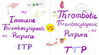 ITP vs TTP Immune Thrombocytopenic purpura vs Thrombotic Theombocytopenic Purpura [upl. by Kristos]