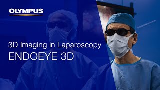 ENDOEYE 3D  What Is the Benefit of 3D Laparoscopy [upl. by Pentheas]