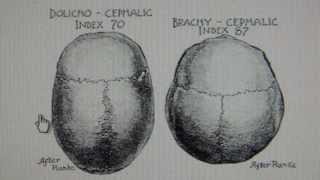 Swiss have Khazarian Brachycephalic Craniometry Cephalometry from Central Asia Mongolia [upl. by Thatch]