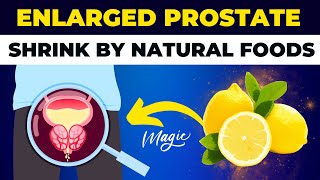 Prostate Enlargement Treat Naturally  Benign Prostatic Hyperplasia [upl. by Iliram]