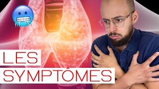 HYPOTHYROIDIE  les symptômes [upl. by Assilaj431]