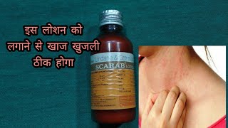 Scarab lotion  lindane and certified lotion  खाज खुलजी के दवा [upl. by Antone]