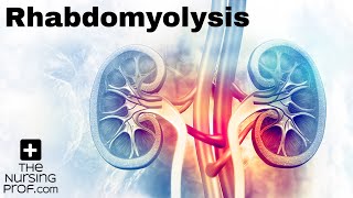 Rhabdomyolysis What You Need to Know [upl. by Yereffej]