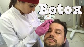 Aplicação de Botox  Toxina Botulínica  mostrando o que uso [upl. by Asillem]