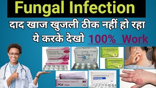 Fungal Infection  Allopathic treatment in Hindi [upl. by Cinimmod358]