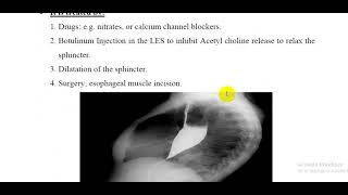 L66 Physiology  Achalasia [upl. by Luamaj]