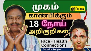 வட்டமான நிலா முகம் ஆரோக்கியமானதல்ல  Face  Health Connections  Face Signs amp Symptoms [upl. by Nazus]