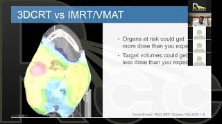 IMRT 20  Physics Session 9  Commissioning Critical 4 How to Recommission a System [upl. by Ardnuat]