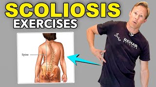 5 Scoliosis Rehab Exercises [upl. by Ludvig]