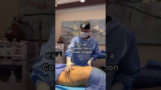 FUPA Liposuction Explained from a Cosmetic Surgeon [upl. by Asikal516]