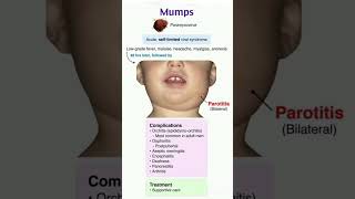 Mumps  Paramyxovirus  Microbiology  Pathology  mbbs  Usmle pharmacology biology neet anatmy [upl. by Gardie]