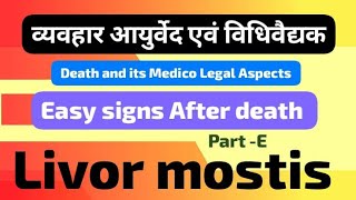 Livor mortis  Post mortem lividity  Early changes After death  sign of death  agadtantra [upl. by Dnalyk]