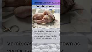 Vernix caseosa Norcet 08 important image Base mcq  Maternity nursingytviralshort [upl. by Reilly]