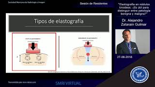 Sesión de Residentes Elastografía en nódulos tiroideos [upl. by Alled]