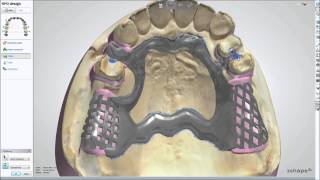 Modellguß im WIELAND 3shape DentalSystem 2013 [upl. by Bywaters]