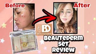 BEAUTEDERM Set Review  Beautederm Before and After  How to use Beautederm Set [upl. by Kcirtapnaes881]