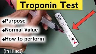 Troponin Test in Hindi  Trop T test Method troponintest nursingcriteria [upl. by Solrac]