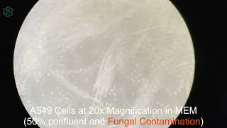 Animal Tissue Culture A549 with Bacterial Contamination and Fungal Contamination [upl. by Bette]