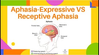 AphasiaExpressive VS Receptive Aphasia  Fluent amp NonFluent Aphasia  PhysiotherapyKnowledge [upl. by Akitahs725]