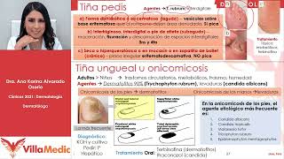 Micosis cutáneas  Dermatología  Villamedic Clínicas 2021 [upl. by Sollars407]