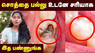 Teeth Care இத செஞ்சா உங்க பல் நட்சத்திரமா மின்னும்💥பல் சொத்தை வராமல் இருக்கணுமா Doctor Advice [upl. by Sancho]