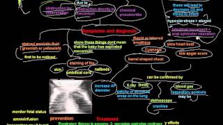 Respiratory Distress in neonates 2 meconium aspiration syndrome [upl. by Sheeran]