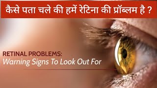 retina problems in eyes  symptoms [upl. by Gnil829]